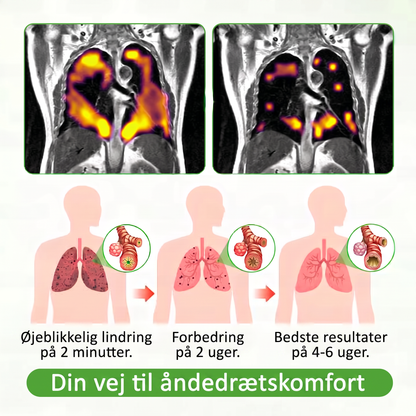 🇩🇰 𝐒𝐭𝐨𝐥𝐭 𝐟𝐫𝐞𝐦𝐬𝐭𝐢𝐥𝐥𝐞𝐭 & 𝐚𝐟𝐬𝐞𝐧𝐝𝐭 𝐢 𝐃𝐚𝐧𝐦𝐚𝐫𝐤✨𝐌𝐮𝐫𝐰𝐨𝐧® 𝐁𝐨𝐭𝐚𝐧𝐢𝐬𝐤 𝐊𝐨𝐧𝐠𝐞𝐥𝐲𝐬 𝐋𝐮𝐧𝐠𝐞𝐫𝐞𝐧𝐬-𝐃𝐢𝐟𝐟𝐮𝐬𝐞𝐫🔥(👨‍⚕️𝐇𝐨𝐬𝐭𝐞, 𝐡𝐚𝐥𝐬𝐛𝐞𝐭æ𝐧𝐝𝐞𝐥𝐬𝐞, å𝐧𝐝𝐞𝐧ø𝐝, 𝐬𝐥𝐢𝐦, 𝐭𝐢𝐥𝐬𝐭𝐨𝐩𝐩𝐞𝐭 𝐧æ𝐬𝐞, 𝐛𝐫𝐨𝐧𝐤𝐢𝐭𝐢𝐬, 𝐚𝐥𝐥𝐞𝐫𝐠𝐢𝐬𝐲𝐦𝐩𝐭𝐨𝐦𝐞𝐫, 𝐮𝐛𝐞𝐡𝐚𝐠 𝐢 𝐥𝐮𝐧𝐠𝐞𝐫𝐧𝐞)𝟏𝟎🐎